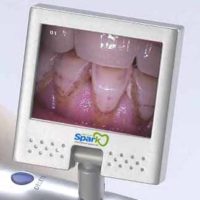 La chirurgie dentaire a examiné le système de came de fil de Digital de dentiste d'appareil-photo de dentiste & 6 LED surlignées CF-986