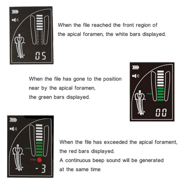 Specht Dental Endodontische Apex Locator wortelkanaalbehandeling Finder CE FDA Woodpex III