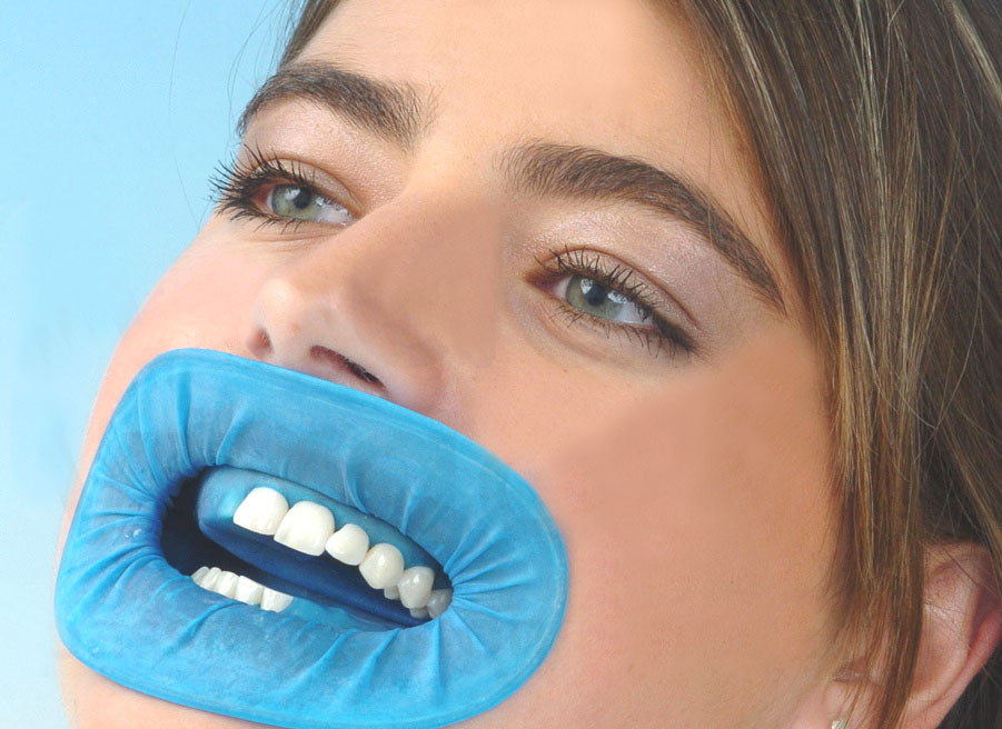 10X dentista Cirurgia Use Dental O-forma azul descartável Borracha Dam Mouth Gag para Absolute Isolamento CE aprovado