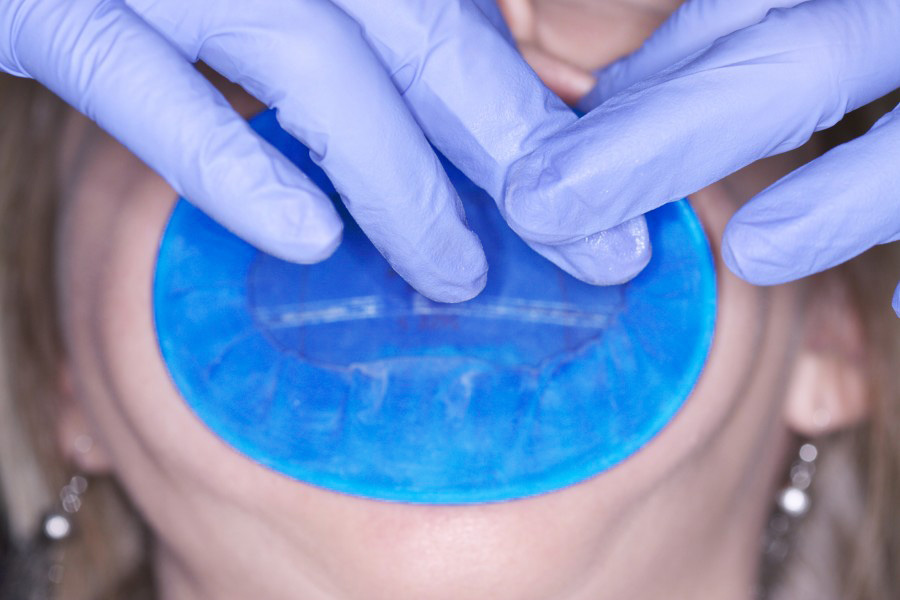 10X dentista Cirurgia Use Dental O-forma azul descartável Borracha Dam Mouth Gag para Absolute Isolamento CE aprovado