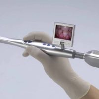 Dental Bezprzewodowe kamery wewnątrzustne Systemy Dentysta Kamery cyfrowe Sony Super HAD CCD CF-988WL